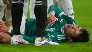 Liverpool star lies on the pitch in pain, surrounded by players in white and green kits, highlighting a serious injury during a match.